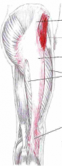 Udspring: Hoftekammen, posteriort for spina iliaca anterior superior (SIAS) 
Insertion: Tractus iliotibialis (lateral kondyl på tibia)
Funktion: Abduktion, flexion og med. rotation af hofteled