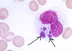 Ehrlichia, vector is tick

Monocytes with morulae (mulberry like inclusions) in cytoplasm

MEGA berry

Monocytes = Ehrlichiosis
Granulocytes= Anaplasmosis