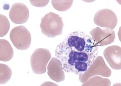 Anaplasma, vector is tick.

Granulocytes with morulae in cytoplasm