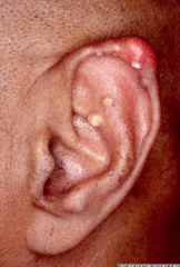 Extensor tendons and tip of ear