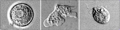 Affects frontal lobes of brain
Trophozoites seen on wet mount
Cultured c lawn of E coli, which it ingests and leaves a trail
Causes Primary Amoebic Meningoencephalitis (PAM)