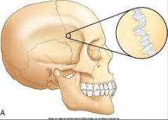 - (i.e., sutures between bones of the skull are not intended to move)