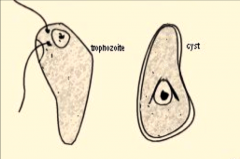 Troph c 2 anterior flagella
Cyst is pear-shaped c birds-beak fibrils around nucleus
Newborn girls at risk of getting respiratory disease and conjunctivitis from infected mothers at birth