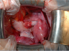 Identify uterus, colon, and left ovary, pouch of Douglas, oviduct