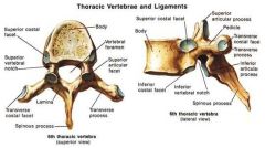 (12) thoracic


facets on vertebral bodies for articulation with the ribs