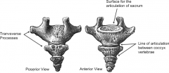 tiny incomplete (no vertebral arch) and 4 fused vertebrae