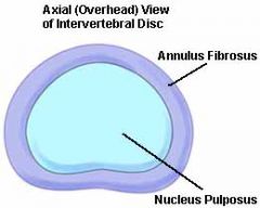 2 portions


inner portion= nucleus pulposus


-mostly water and is maintained in central position by the annular rings that are firmly attached superiorly and inferiorly to adjacent vertebral bodies


outer structure = annulus fibrosis = layers o...