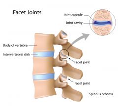 aka facet joints


plane synovial joints between inferior and superior articular processes of adjacent vertebra