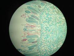 Phylum: Bryophyta


Subject: Mnium Antheridia


Function: Sexual reproduction