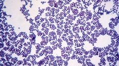 Peptidoclycan Layer captures the violet stain 