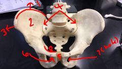 
Pelvis Anterior

1. Iliac crest 

2. Iliac fossa
3. Anterior superior iliac spine
4. Sacroiliac joint
5. Public symphysis
6. Pubic turbercle
7. Obturator foramen
8. Pectineal Line