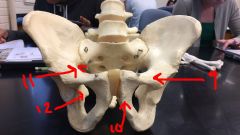 Pelvis Anterior

9. Superior spine
10. Inferior ramus
11. Greater sciatic notch
12. Ischial spine
