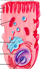 A diagram shown below.1. Which of the following is an example of a pathology of this cell?
a. Gauch disease
b. Tay sachs
c. Sinus intertisus
d. Celiac sprue 
e. Mitochondrial disorder
