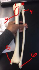 Tibia and Fibula (Left Leg)

1. Medial Condyle
2. Lateral Condyle

3. Tibial Tuberosity

4. Fibula Head

5. Medial Malleolus

6. Lateral Malleolus