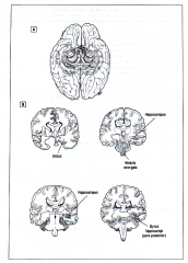 Figuur 4.4.


 


A .


Onderaanzicht van de neurochirurgisch verwijderde hersenzones bij patiënt H.M.




B.


Coronale doorsnedes (van anterior naar posterior) die H.M.'s hersenlaesie illustreren . De structuren werden bilateraal ve...