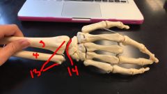Connection to Hand

3. Radius

4. Ulna

13. Styloid processes

14. Radiocarpal joint
