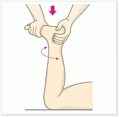 Diagnóstico de meníscos


Con paciente en decúbito prono se flexiona la rodilla y se ejerce compresión mientras se rota esta