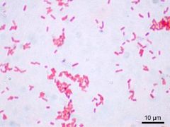 Serratia (microscopic morphology)
Gram negative, acid negative, endo negative
Bacillus