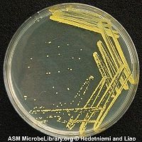 Micrococcus (culture media)
Bright/buttery yellow, smaller, round, opaque, entire