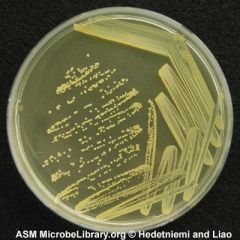 Staphylococcus aureus (culture media)
Beige, dry, irredescent, opaque
