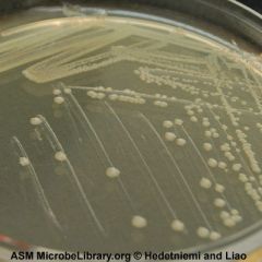 Escherichia coli (culture media)
White, mucoid, glistening, opaque