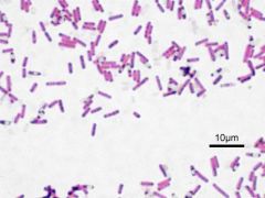 Bacillus (microscopic morphology)
Streptobacillus
Gram positive, acid neg, endo positive