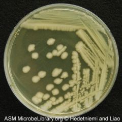 Bacillus (culture media)
Beige, dry, rough, transparent