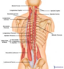 erector spinae in 3 vertical columns:


Think "I Like Spaghetti"


1. iliocostalis (lateral)


2. longissimus


3. spinalis (medial)


Action:


bilat: extend head and vertebral column


unilaterally: lateral flexion of head and vertebral column

...