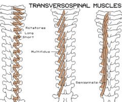 1. SEMISPINALIS


2. MULTIFIDUS


3. ROTATORES


collectively these = transversospinal muscles bc fibers attach between tranverse processes and spinous processes of the vertebrae


Action:


bilaterally: extend and stabilize spine


unilat: latera...