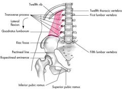 lumbar spine stabilizer


unilateral: elevates ilium


bilat: assists in forced exhalation and extends back