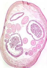 Cross section of Ascaris (Roundworm)
