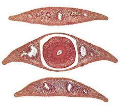 - Cross section of Planaria (Flatworm)