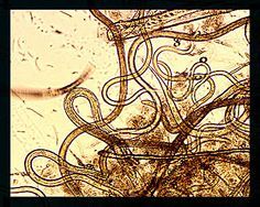 Vinegar Eel

- Roundworm (Pseudocoelomate= cavity between endoderm & mesoderm)