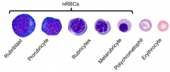 Rubriblast -> Prorubricyte -> rubricyte -> metarubricyte -> polychromatophil -> RBC