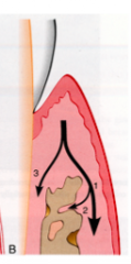 from the gingiva along the outer periosteum (1) --> from the periosteum into the bone (2), and from gingiva into PDL (3)