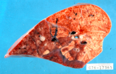 Pneumonic
pasteurellosis

P. multocida (types A and D)
 