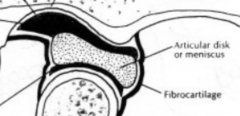 dense fibrous connective tissue


avascular


aneural