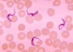 1. Flagellate


2. Asexually, but also rare sexual


3. Extracellular in blood


4. - Possess kinetoplast which is just a DNA clump


- May also have undulating membrane


5. Trypanasoma (african sleeping sickness)


Leishmania (leishmaniasis)


6...