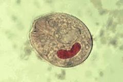 1. Small cilia


2. Both asexual and sexual


3. Inabit aquatic environments and faeces


4. i) Have 2 nuclei (macro+micro)


ii) Contractile vacuole


5. E.g. Balantidium coli


- Fecal transmission of cyst


- Causes Balantidiasis (explosive dia...