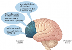 What can you tell from this diagram?

Lesionsto toposterior frontal lobes cause what?
To middle frontal lobes?