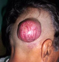 What is this and what is a possible diagnosis?