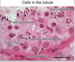 1. Sertoli Cells: Physically and metabolically support developing sperm, form blood testis barrier (Prevent autoimmune attacks)
2. Spermatogenic Cells: Produce Sperm