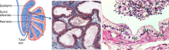 1. Connect Rete Testis to Epididymis
2. Scalloped or Festooned Epithelium
3. Alternates between non-ciliated cuboidal cells with microvilli and taller ciliated cells