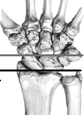 Identify the radiocarpal and midcarpal joints