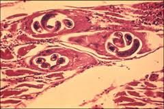 1. Transmitted through multiple intermediate hosts


2. Invades the body through ingestion of cyst meat


3. Hides from defender by living within muscle cells


4. Forms a tough cyst within muscle


5. Pig and Rat intermediate hosts


6. No asexua...