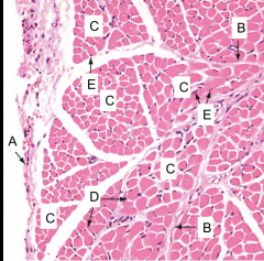 This is an image of the skeletal muscle. What is A?