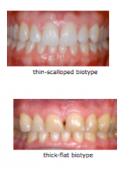 Thin-scalloped 
Thick-flat 
Thick is more prevalent than thin (85% vs. 15%)