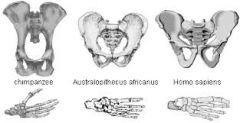1. Intermediate and broader at A.afarensis


2. Becomes bowl-shaped at A.sediba


3. Becomes similar to modern humans (even broader) with premature births needed for large skull to fit through at H. erectus


 