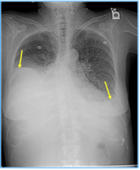 What is shown here? Describe and condition.