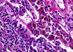 What is this an image of?
Diagnose.
Etiology?